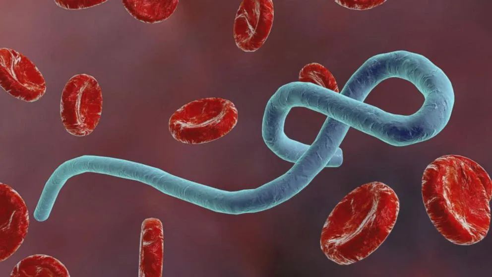 Canada and Bahamas Shut Borders to Travellers from Three African Nations Over Ebola Fears