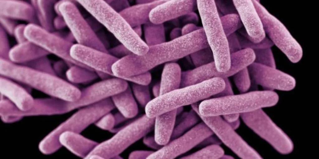Dangerous Drug-Resistant TB Strain Discovered in Cape Coast Hospitals