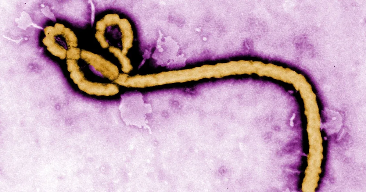 France Detects First Ebola Case Outside Africa as Doctor Tested Positive